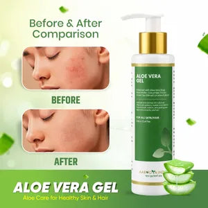 Aloe Vera Gel Pack Of 2
